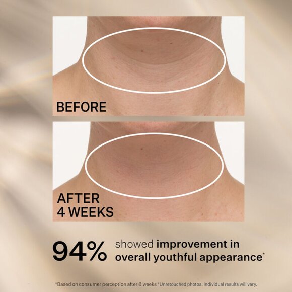 StriVectin TL Advanced™ Tightening Neck Cream PLUS Jumbo 3.4oz - Picture 2 of 7